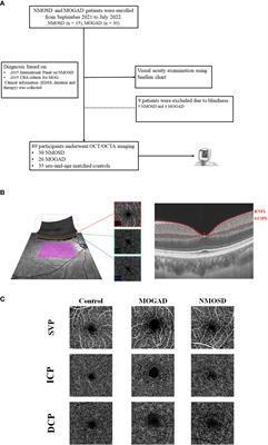 Retinal structural and microvascular changes in myelin oligodendrocyte glycoprotein antibody disease and neuromyelitis optica spectrum disorder: An OCT/OCTA study
